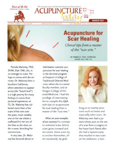 AcupunctureToday_Acupuncture-for-Scar-Healing_DrPamelaMaloney