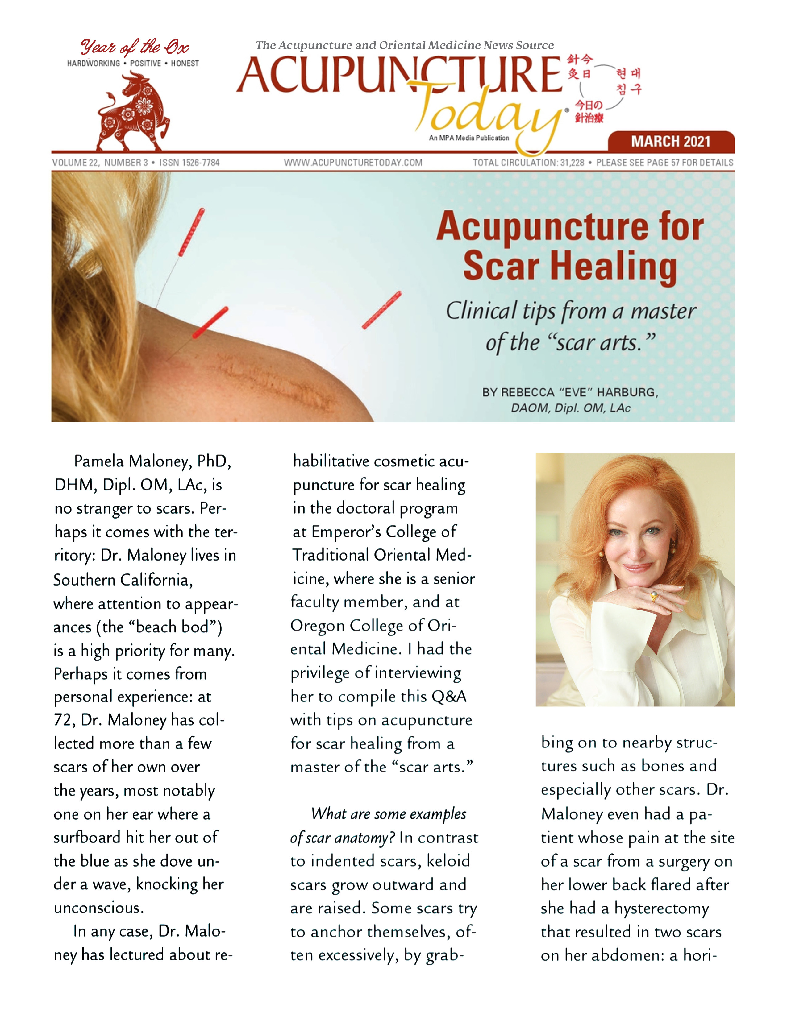 AcupunctureToday_Acupuncture-for-Scar-Healing_DrPamelaMaloney